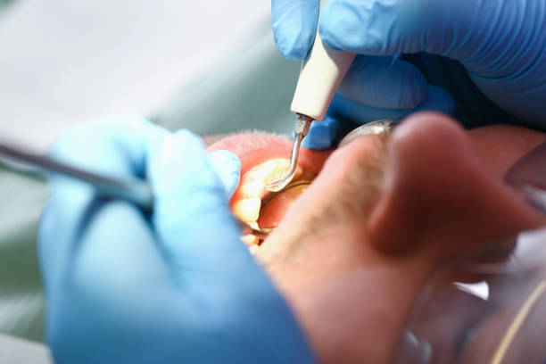 Best Emergency Dental Care for Trauma or Injury in Port Clinton, OH